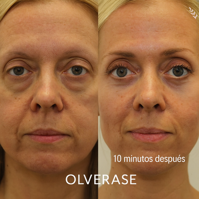 OLVERASE – Borrador de Ojeras
